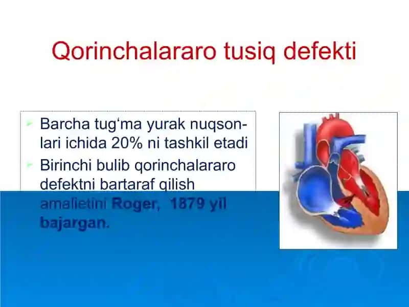 Tug‘ma yurak nuqsonlari 4