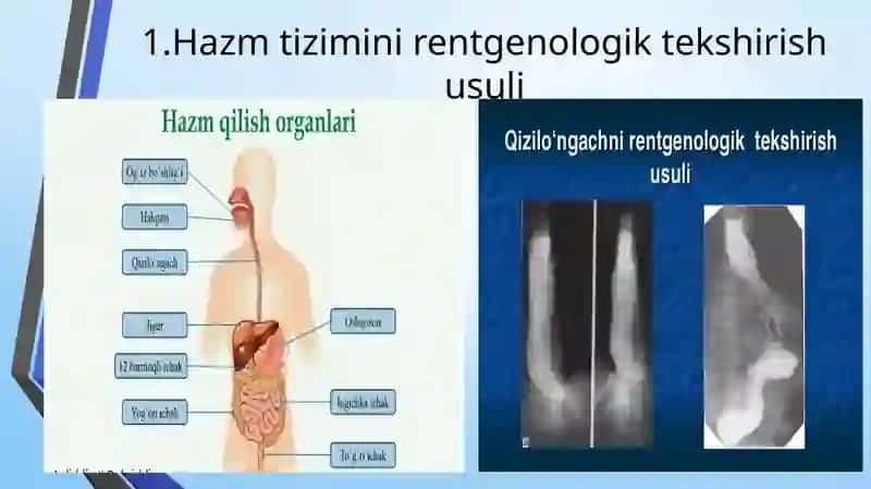 Hazmtizimini instrumental tekshirish usullari 4