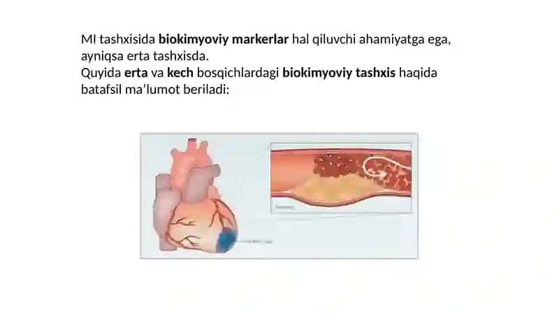 Miokard infarktining erta va kech biokimyoviy tashxisi 4