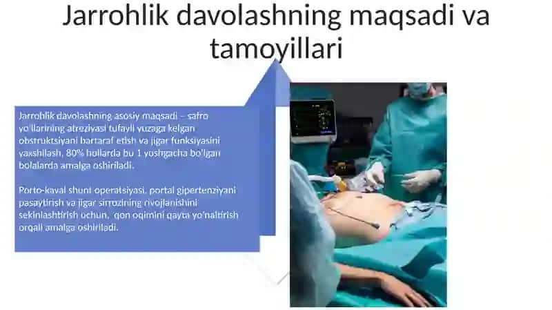 Porto-kaval shuntlash operatsiyalari 4