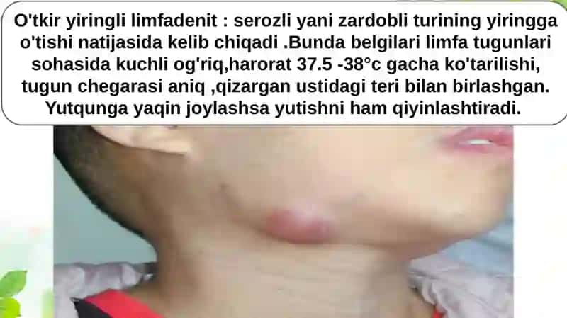 Bolalardayuzyumshoqto'qimalariningodontogenyallig'lanishjarayonlari 4