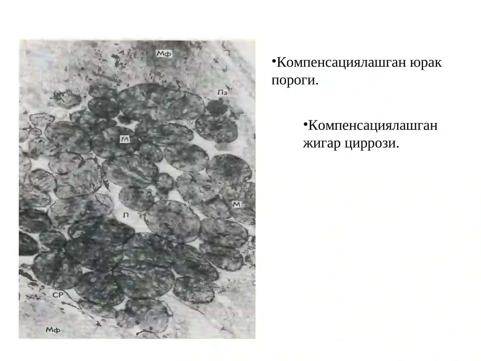 Лекция 11: КОМПЕНСАТОР – МОСЛАНИШ ЖАРАЙОНЛАРИ 4