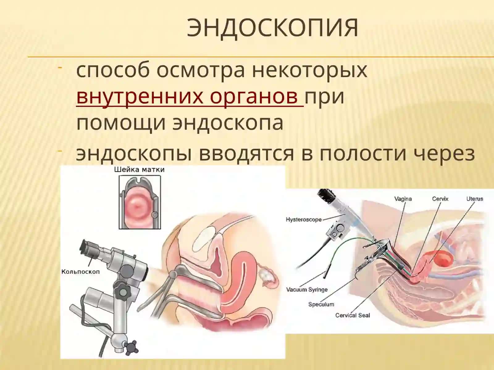 Малоинвазивная хирургия 4