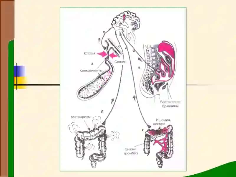 ОВКАТ ХАЗМ КИЛИШ АЪЗОЛАРИ КАСАЛЛИКЛАРИ БУЛГАН БЕМОРЛАРНИ ТЕКШИРИШ 4