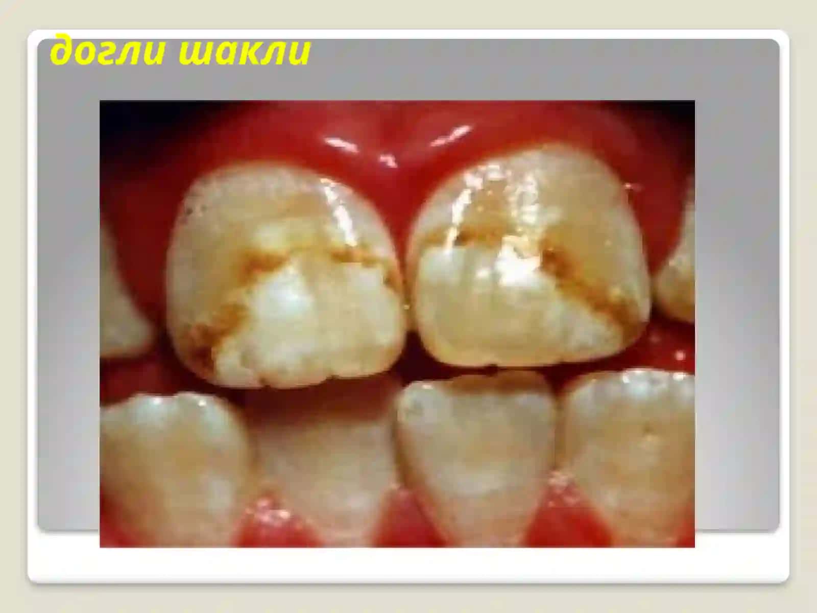 Флюороз 4