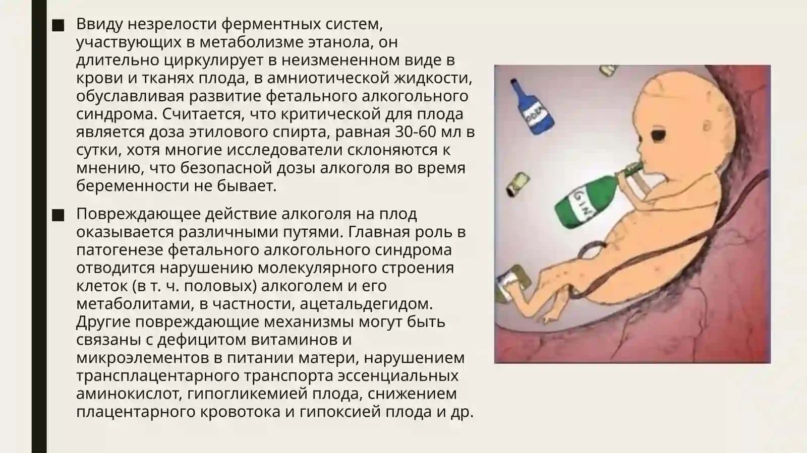 Фетальный алкогольный синдром. (Симптомы и Причины) 4