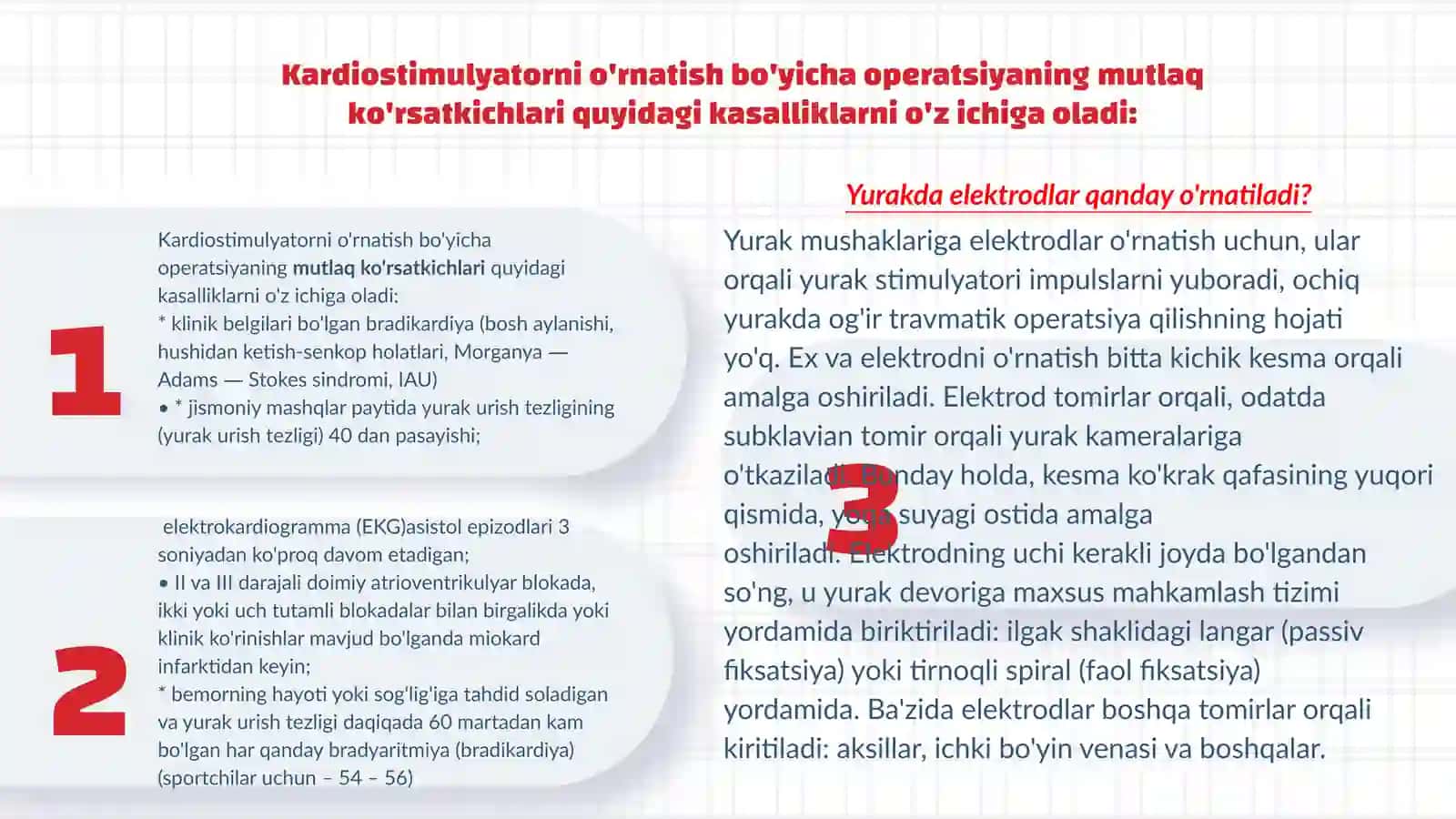 Kardiostimulyatsiya tushunchasi va usullari 4
