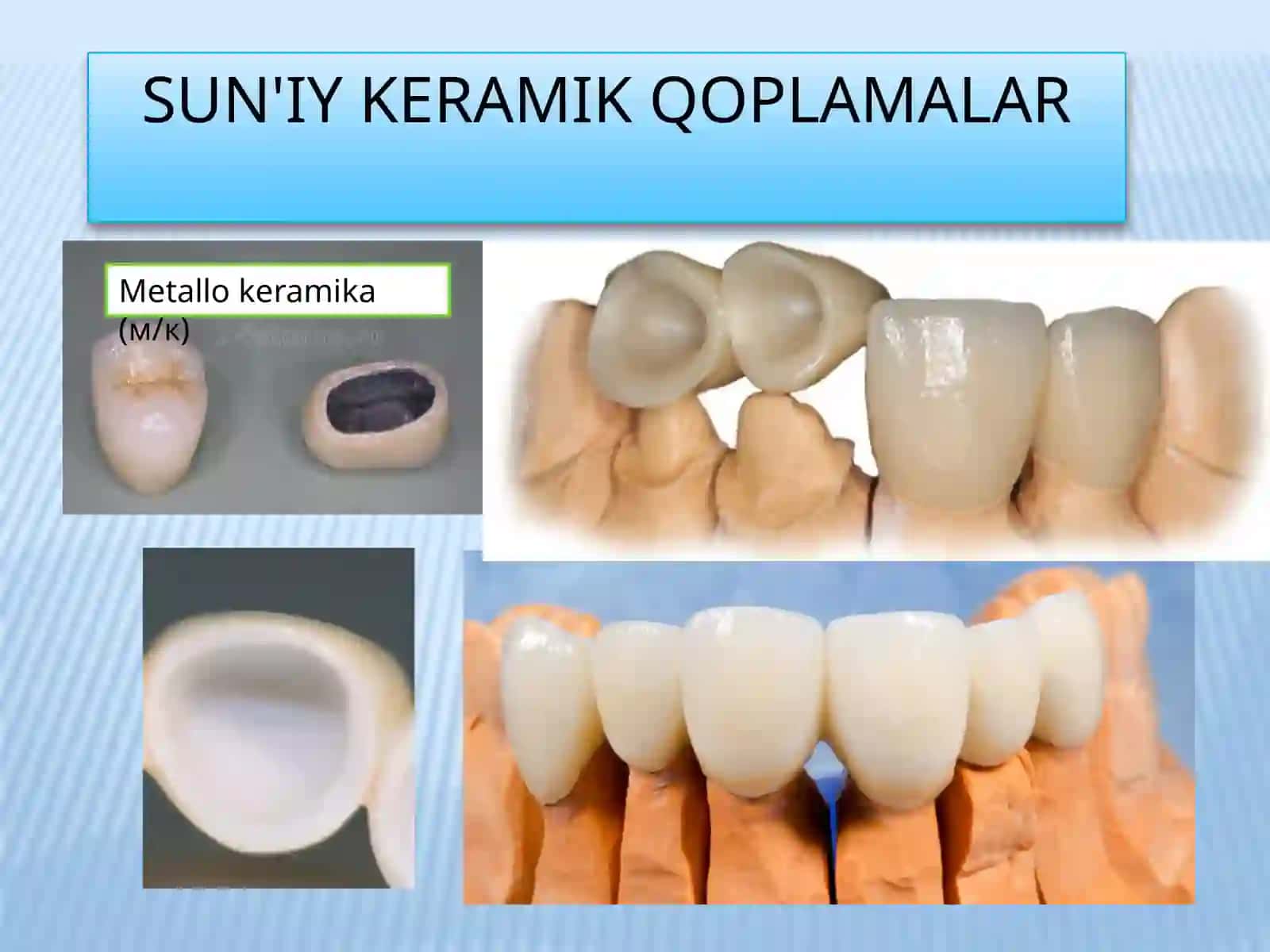 Sirkoniy dioksid stomatologik keramika farfor 4