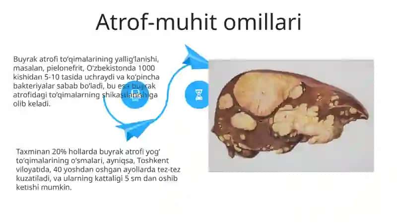 Buyrak ektopiyasi 4
