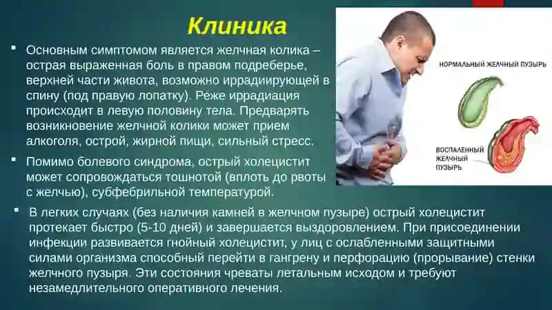 Холецистит 4
