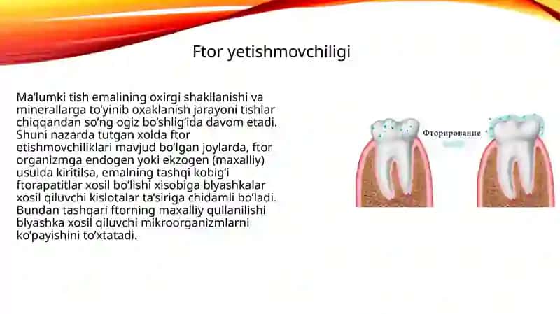 Mavzu:Stomatologik kasalliklar profilaktikasida ftor saqlovchi birikmalarning ahamiyati. Ftor saqlovchi tabletkalar. 4