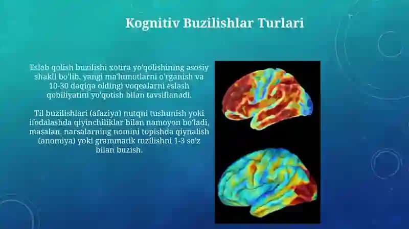 Alzheymer kasalligi 4