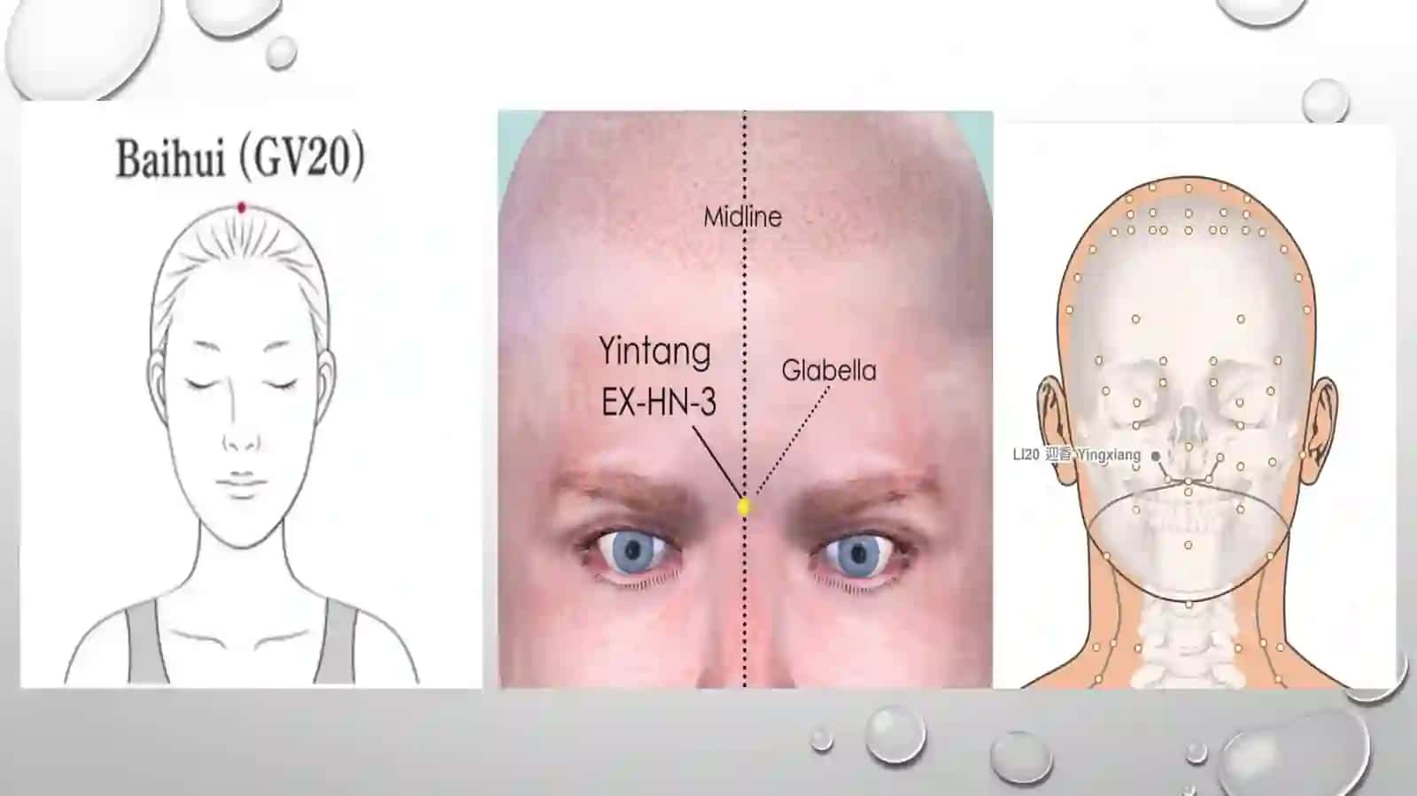 Bolalarda acupuncture nuqtalar topografiyasi 4