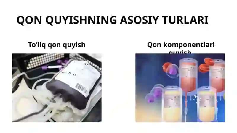 Qon quyish. Qon kuyish usullari. Quyilgan qon ta’sir mexanizmi. Asosiy transfuzion vositalar. 4