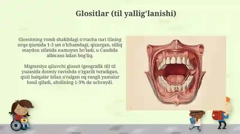 Og'iz bo'shlig'i shilliq qavatining kassaliklari 4