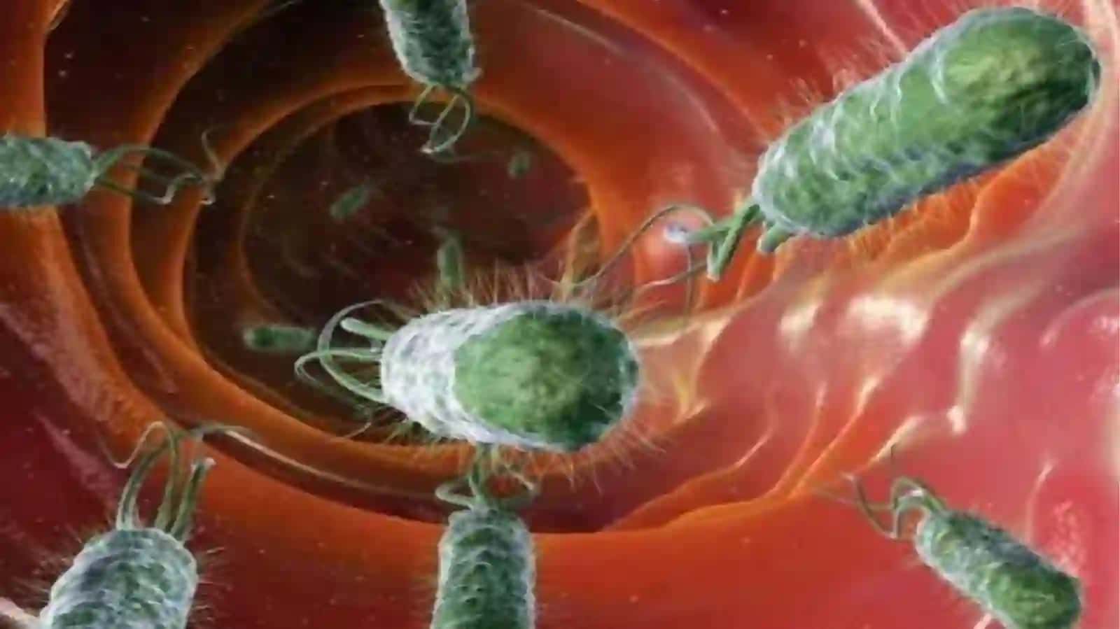 O‘tkirichak infeksiyalari epidemiologiyasi va profilaktikasi 4