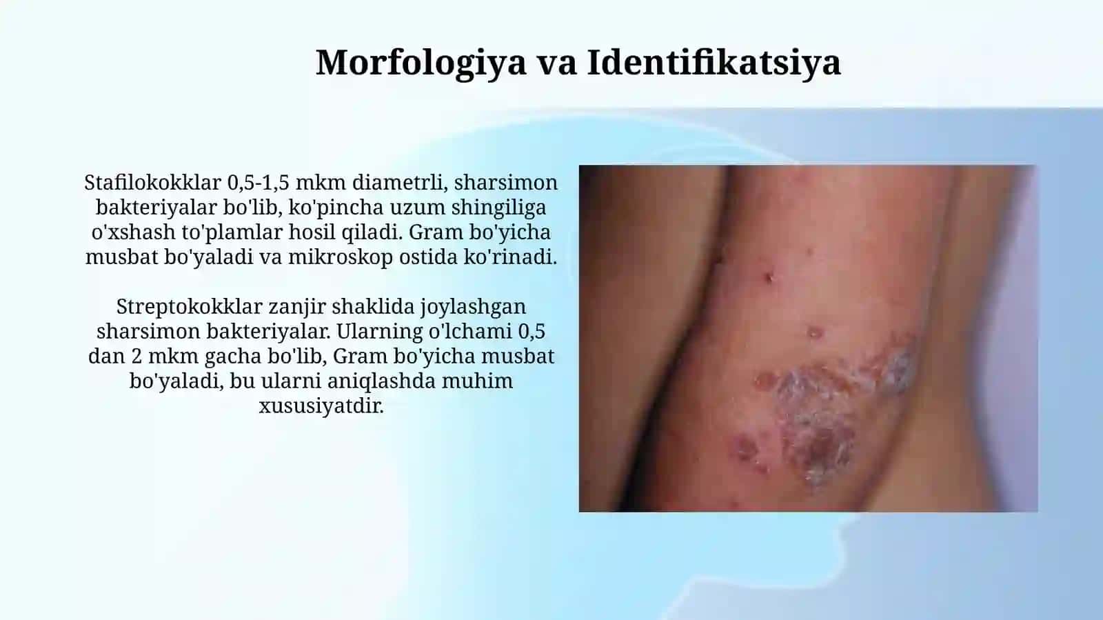Stafilokokklar, Streptokokklar va Pnevmokokklar: Umumiy Tavsif va Klinik Ahamiyati 4