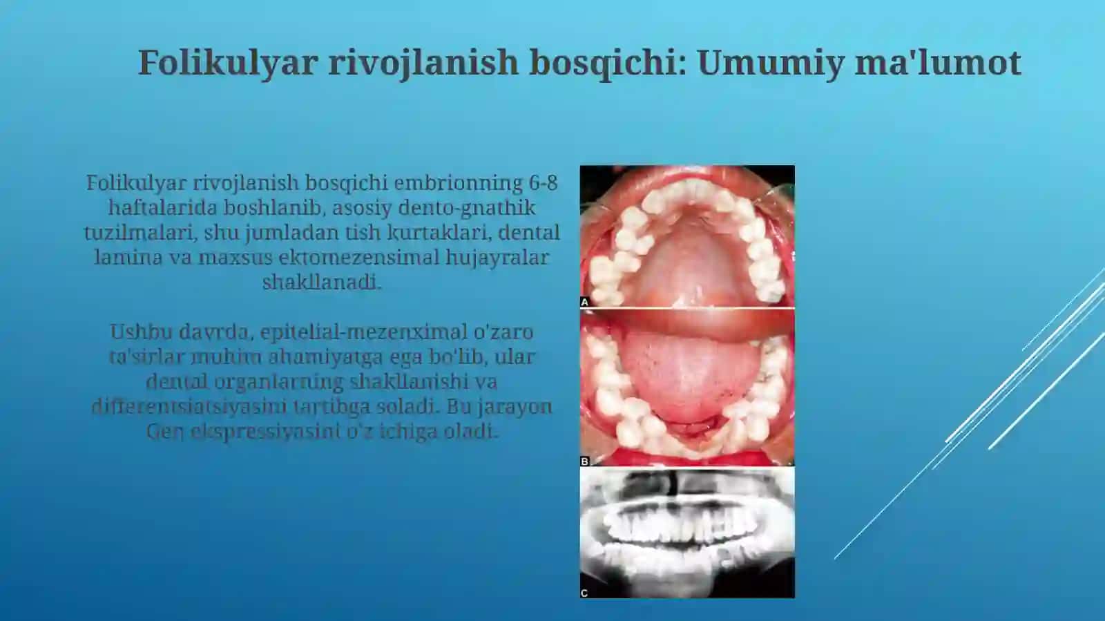 Tish to’qimalarining follikulyar rivojlanish davrida yuzaga keladigan shikastlanishlar 4