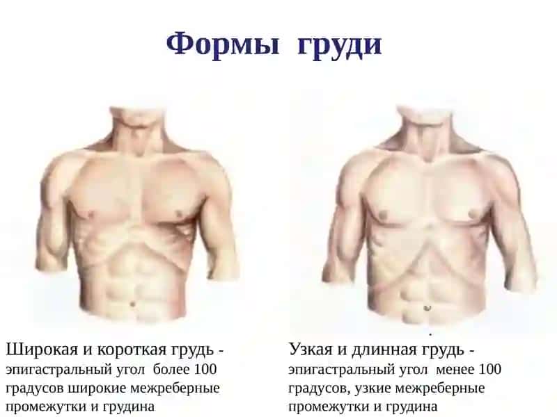 Операции при врожденных и приобретенных дефектах грудной стенки 4