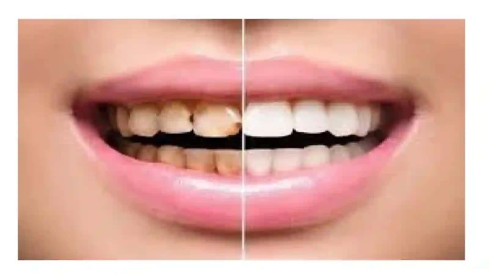 Dentinogenez 4