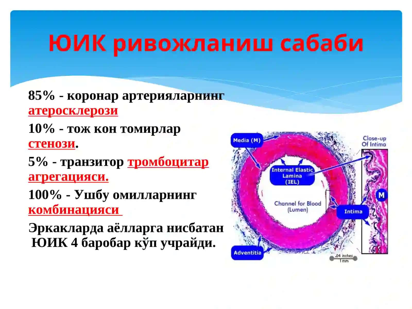 ЮРАК ИШЕМИК КАСАЛЛИГИ.АСОСИЙ СИМТОМЛАР ВА СИНДРОМЛАР 4
