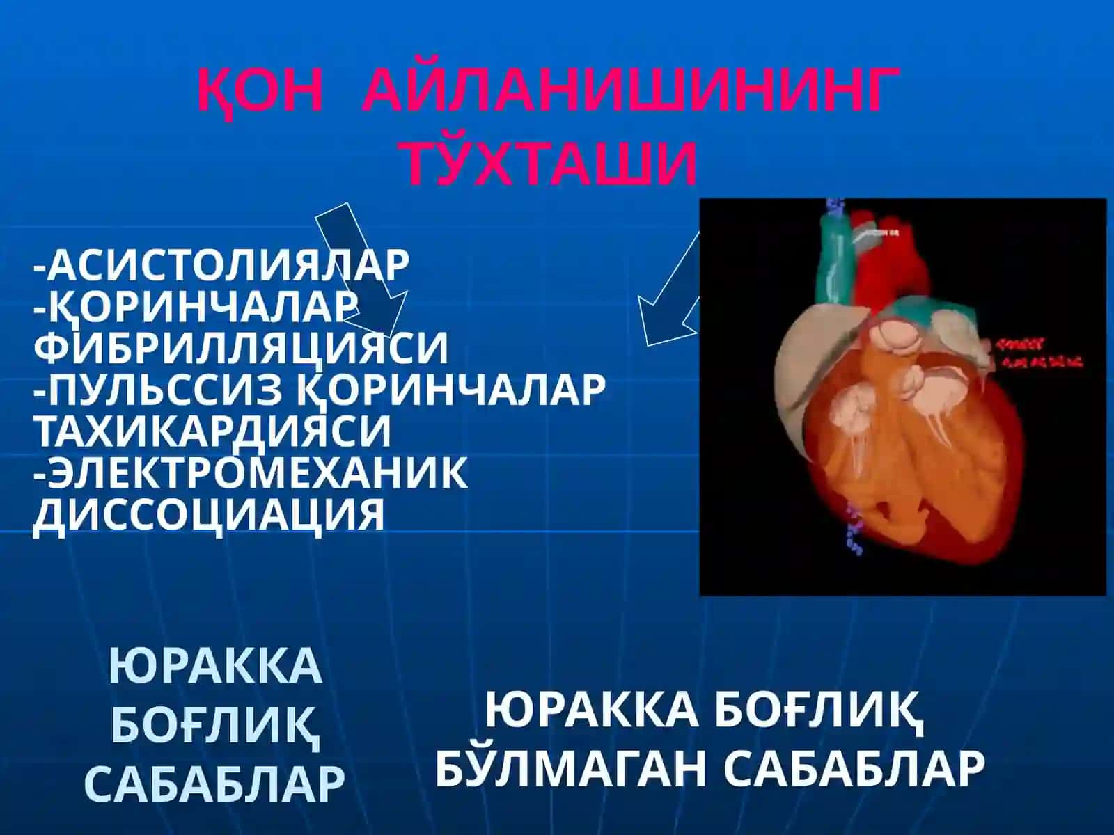 ЮРАК - ЎПКА  РЕАНИМАЦИЯСИНИ ЎТКАЗИШ 4