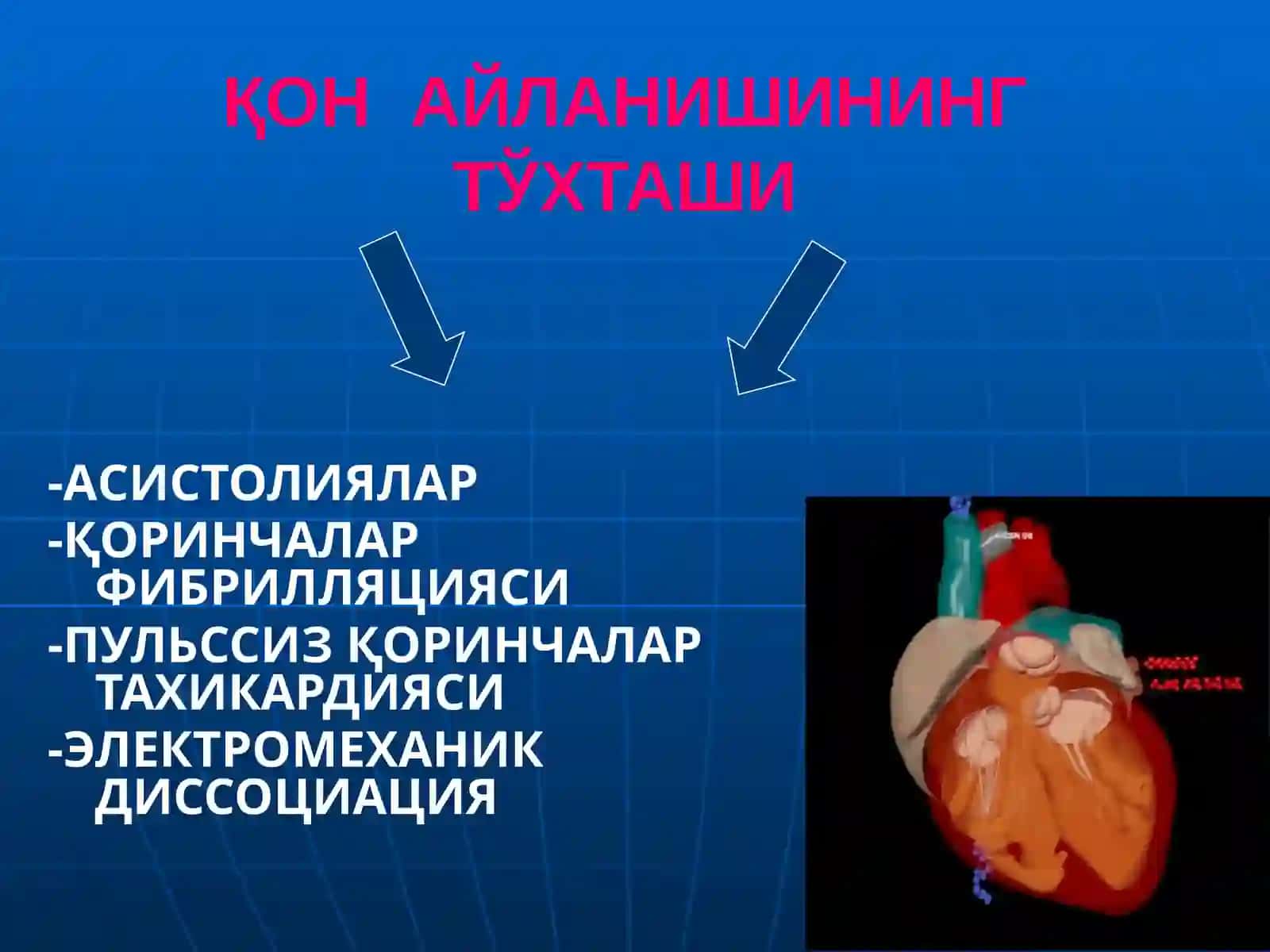ЮРАК - ЎПКА РЕАНИМАЦИЯСИНИ ЎТКАЗИШ 4