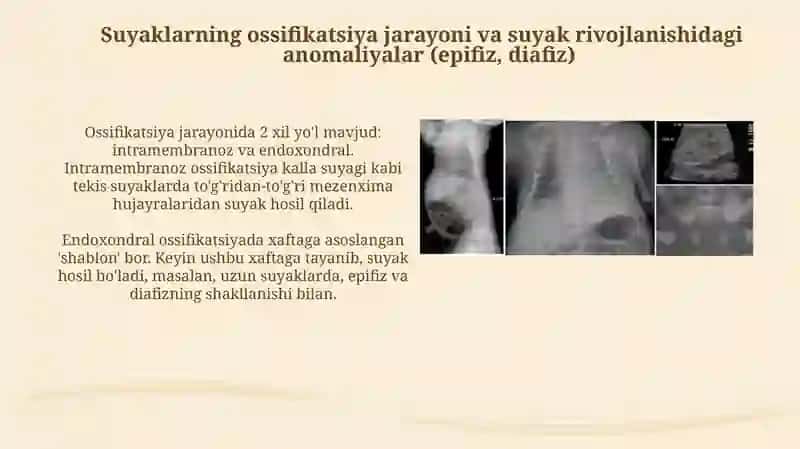 Skelet suyaklarining rentgenanatomiyasi 4