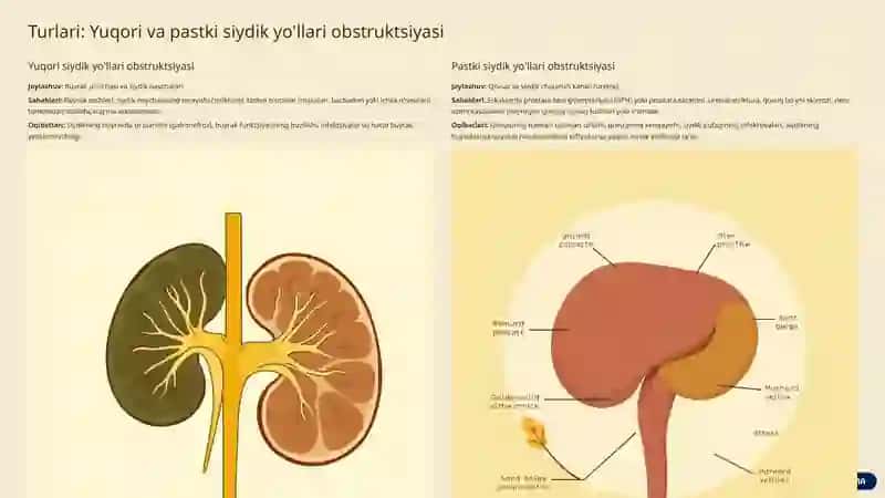 Siydik yo'llari obstruktsiyasi 4