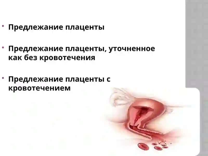 СТАНДАРТ ПО Ведение беременных с кровотечением после 22 недель 4