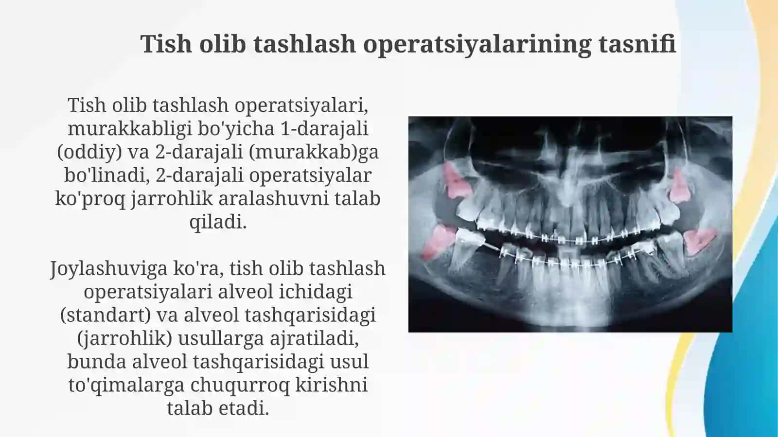 Tish olish operatsiyalari, koʻrsatma va qarshi koʻrsatmalar.Asoratlar 4