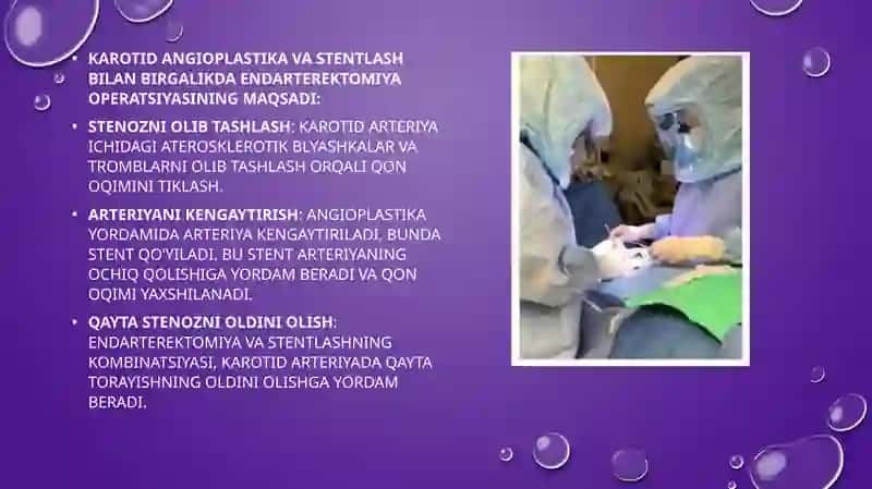 KAROTID ENDARTEREKTOMIYA 4
