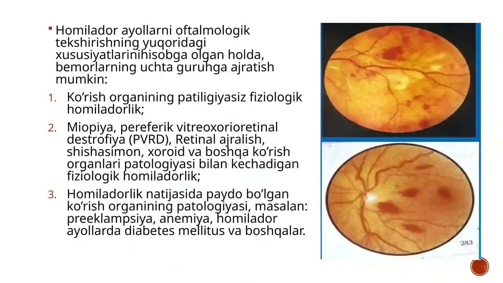 Homiladorayollardaoftalmikholatningklinikxususiyatlari 4