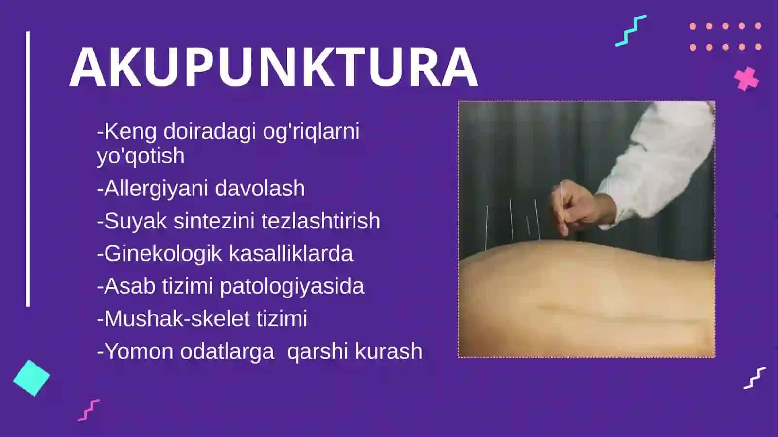 Akupunktur. Texnikaning mohiyati, ko'rsatmalari, kontrendikatsiyasi 4
