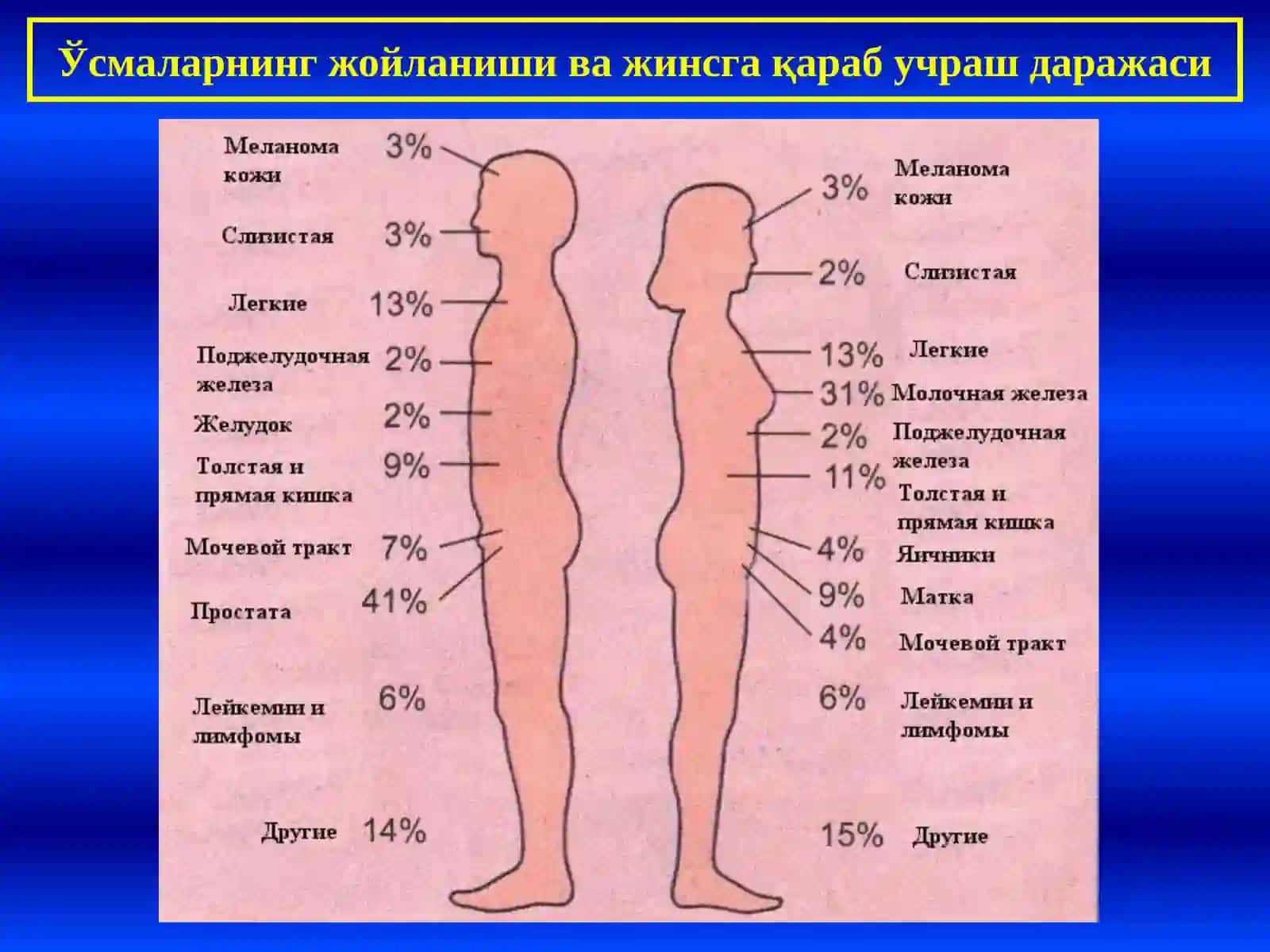 Неоплазия, умумий тушунчалар. Эпителий ўсмалари, Мезенхимал ўсмалар, Меланинли ва нерв тўқима ўсмалари 4