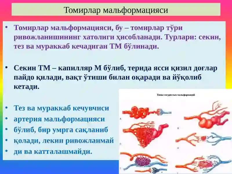 Қон томирлар патологияси. Томир аномалиялари. Гипертензия. 4
