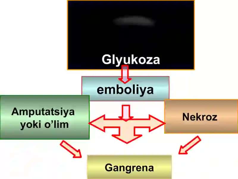 Qandli diabet 4