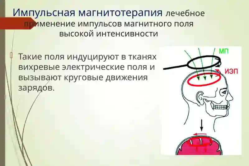 Лечение магнитным полем в стоматологии 4