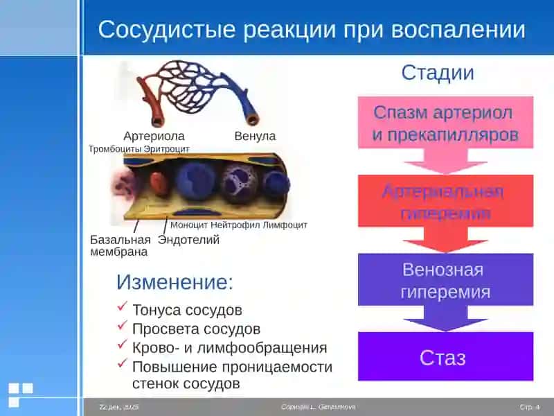 Экссудация Пролиферация Значение воспаления 4