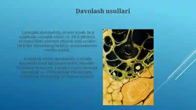 Otorinolaringologiya 4