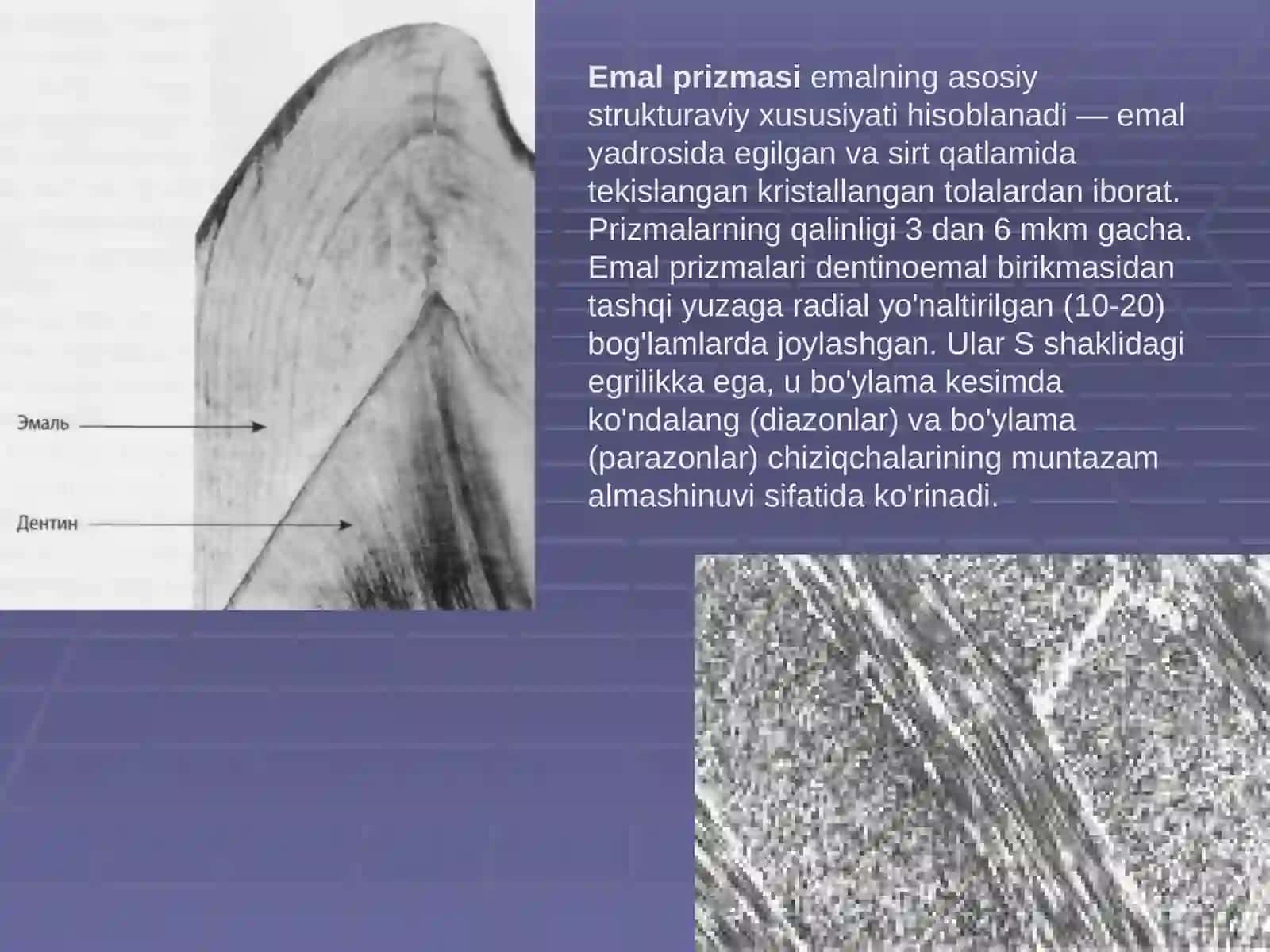Emalning oʻtkir o'choqli demineralizatsiyasi 4
