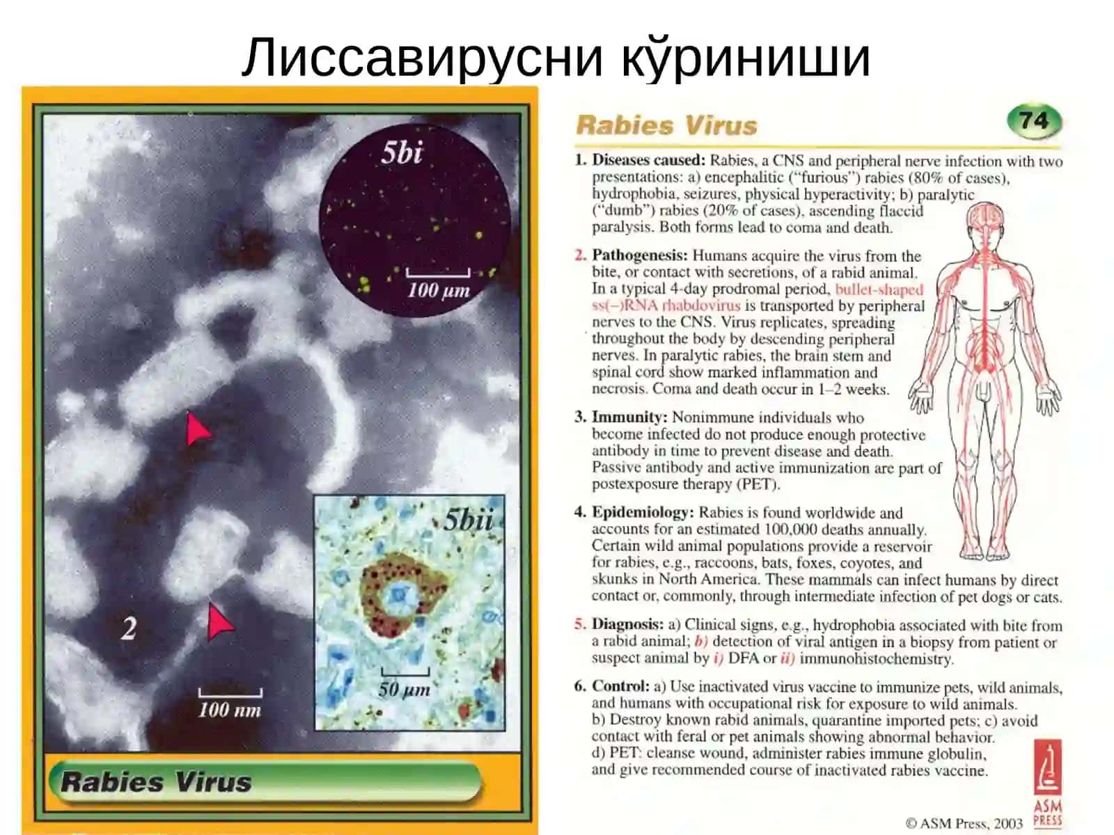 Қутуришкасаллиги ваунгақарши кураштадбирлари 4