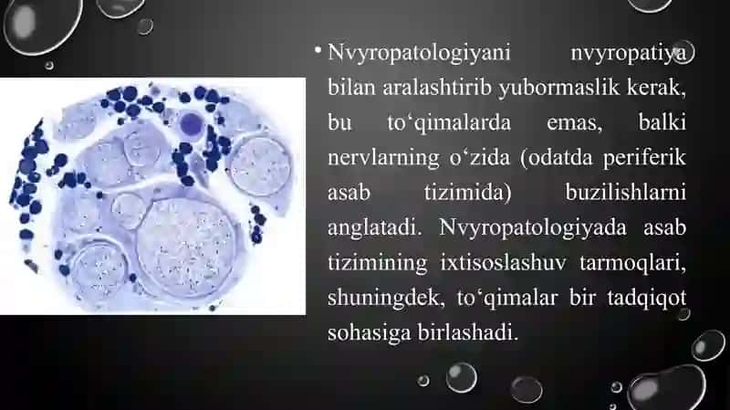Xususiy nevropatologiya. Bosh miyaning infeksion kasaliklari 4