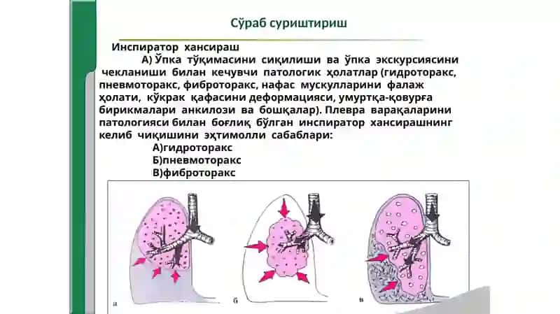 Нафас тизими касалликларида  беморларни  текшириш. 4