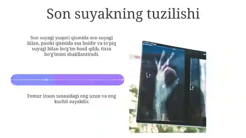 Chanoq suyagi va son suyagi 4