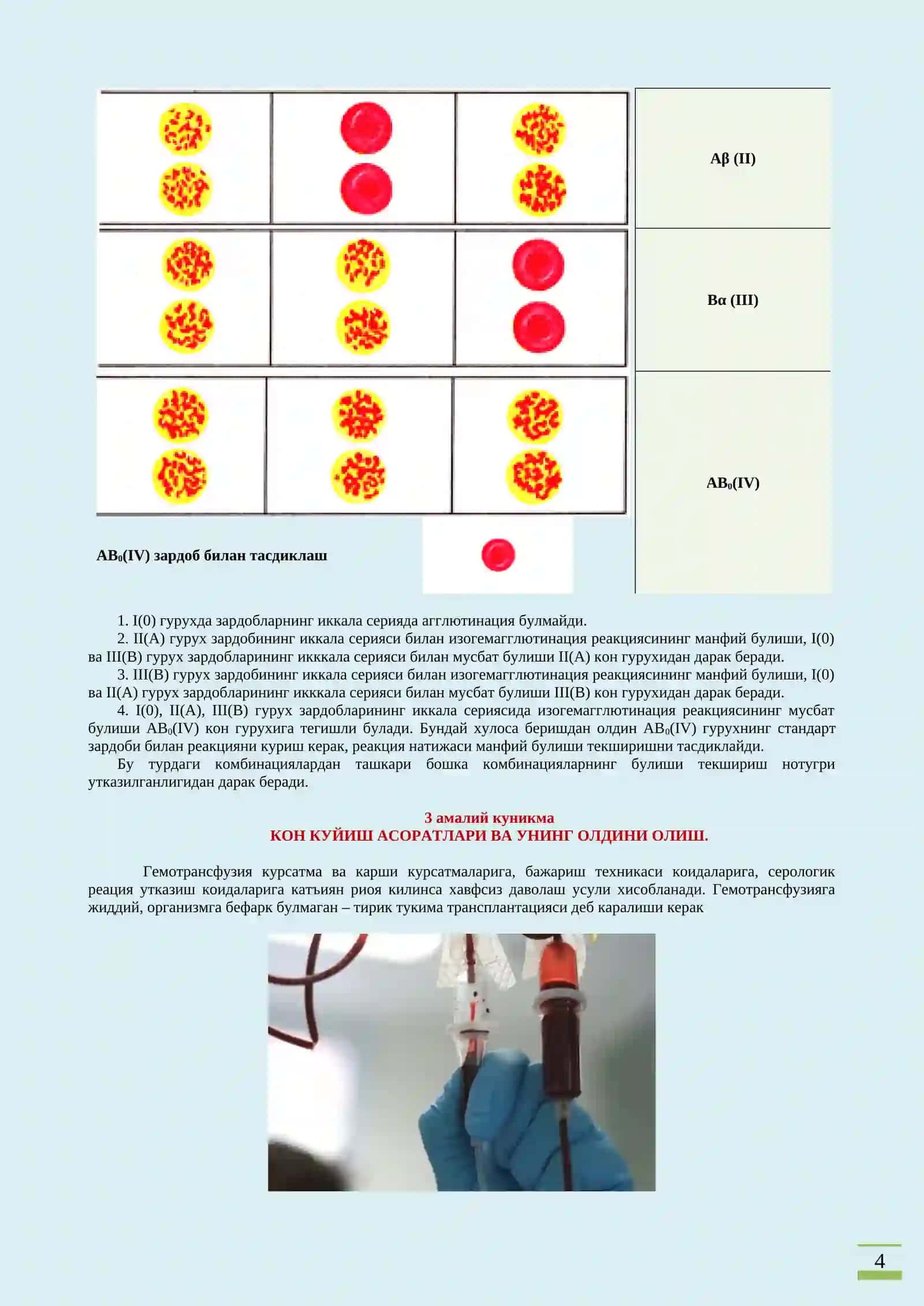 Периферик веналар пункцияси ва катетеризацияси 4