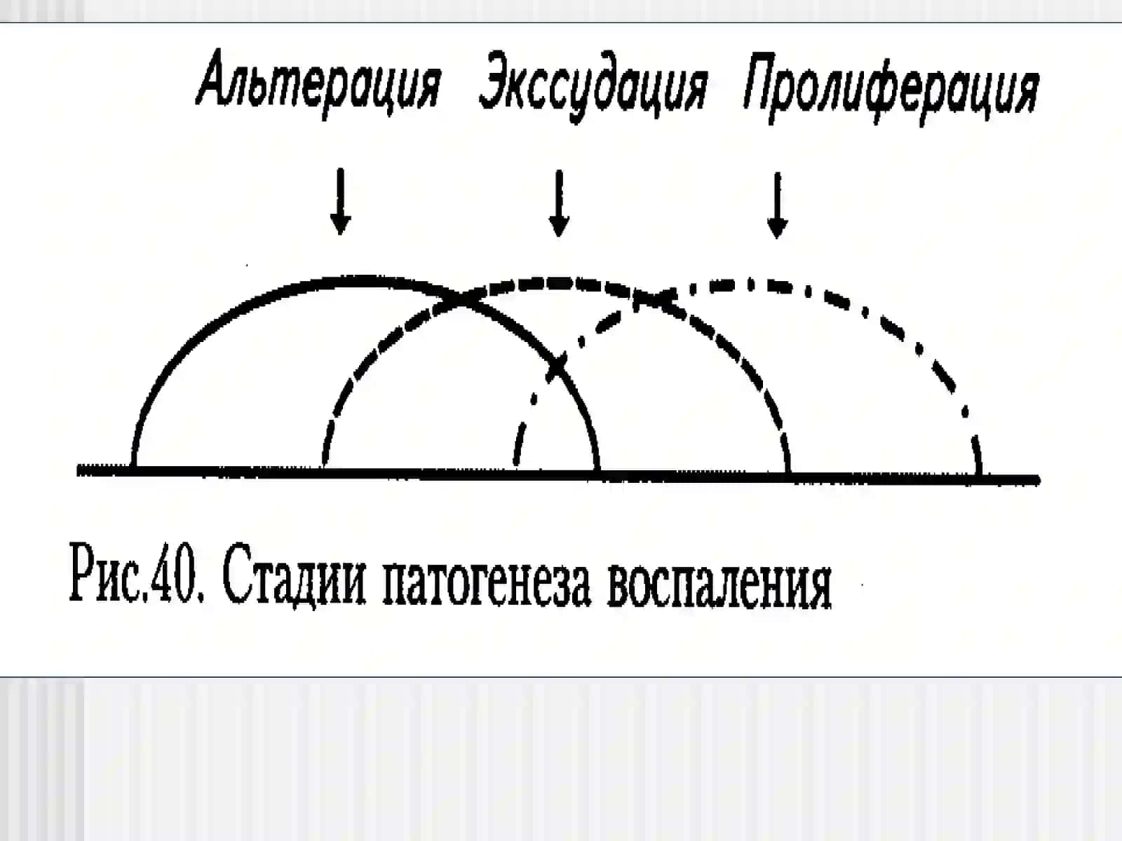 Яллигланиш хакида тушунча, яллигланиш медиаторлари ва уларнинг шок ва сепсисдаги таьсири 4
