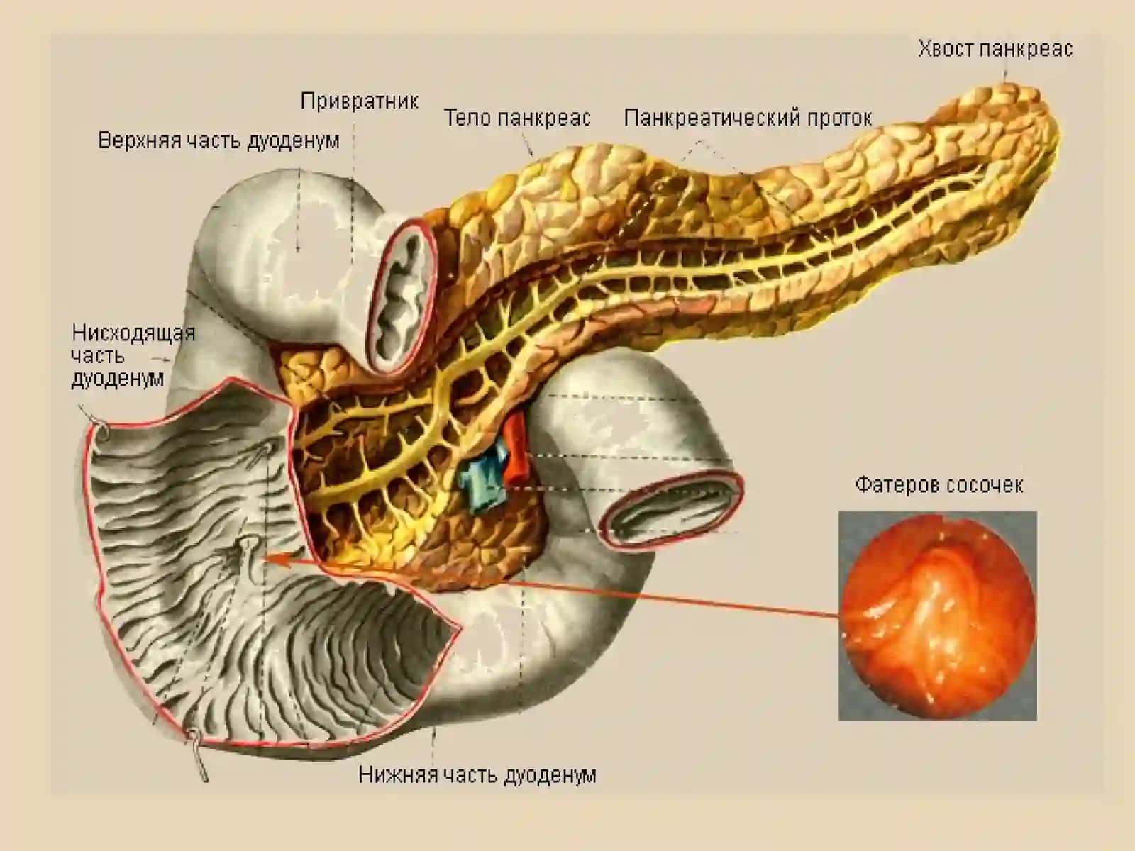 Панкреатит 4