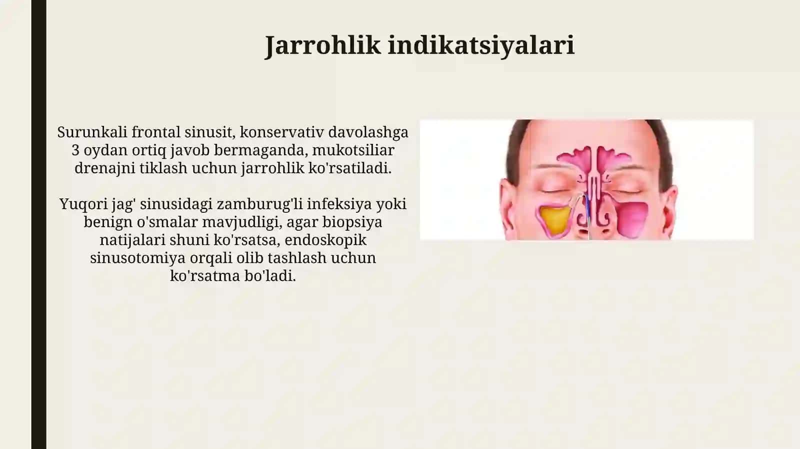 Peshona va yuqori jagʻ boʻshliqlarini ochish texnikasi. Endoskopik fronto- va gaymorotomiya usullari 4