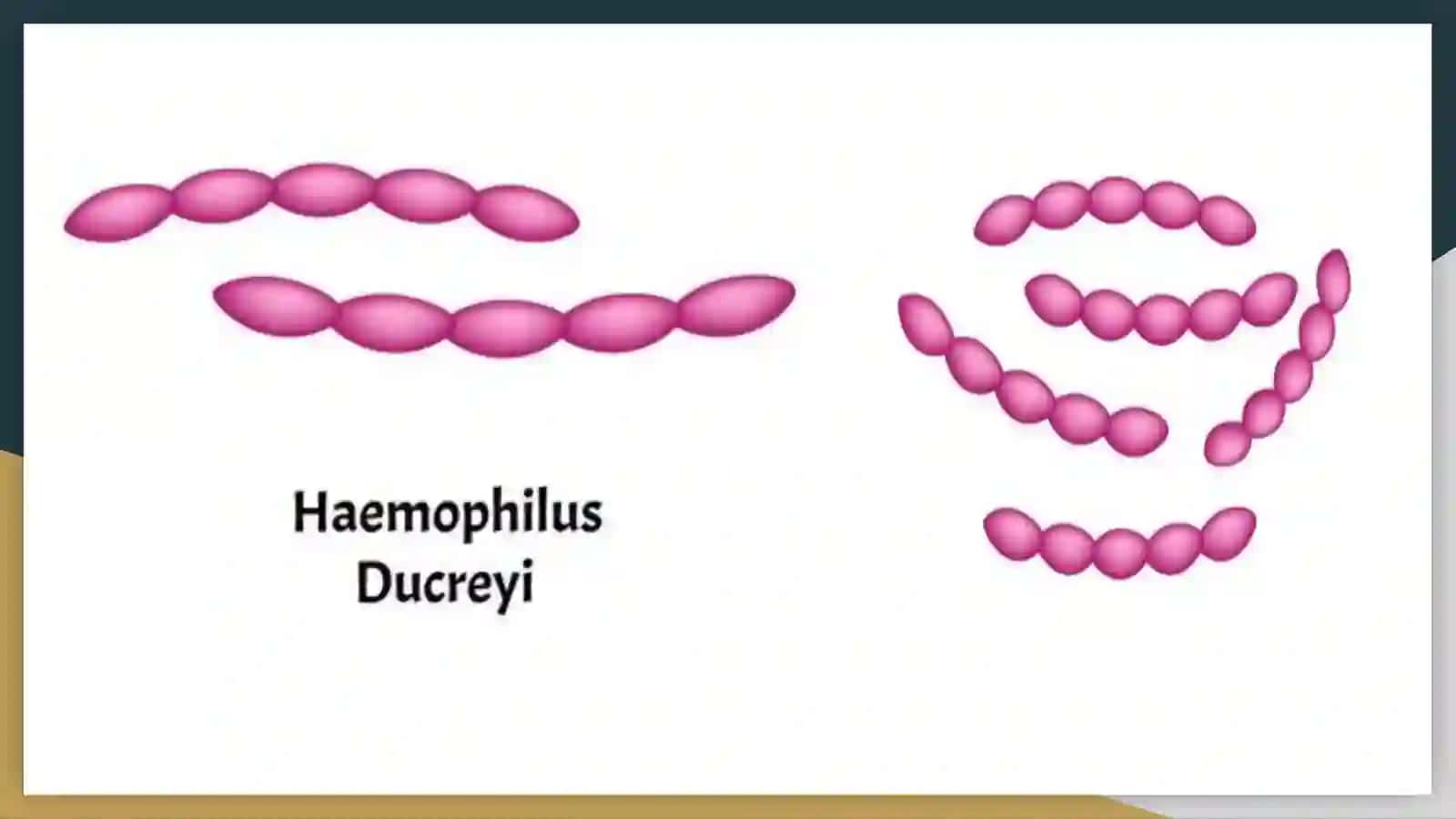 Gemofil bakteriyalar(yumshoq shankr qoʻzgʻatuvchisi)ularni amaliyotdagi ahamiyati, diagnostikasi 4